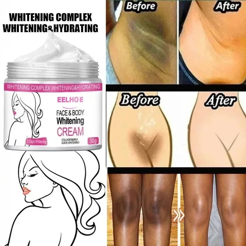 Skin lightening cream for reducing dark spots and pigmentation