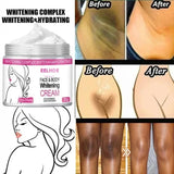 Skin lightening cream for reducing dark spots and pigmentation