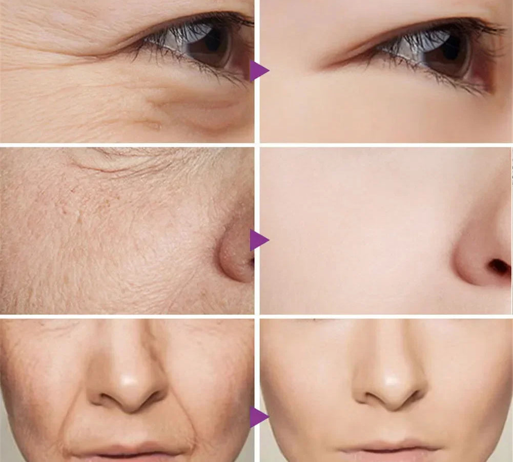 Powerful serum to reduce wrinkles and fine lines